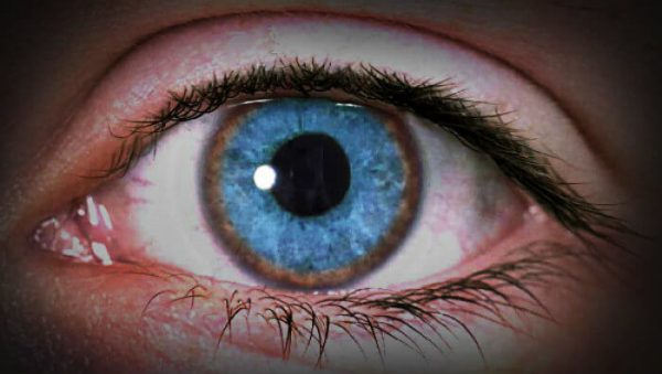 La-pigmentación-verdosa-alrededor-del-iris-es-característico-de-la-enfermedad-de-Wilson