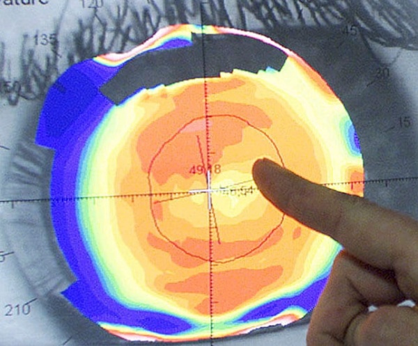 wilson-enfermedad-tribuna